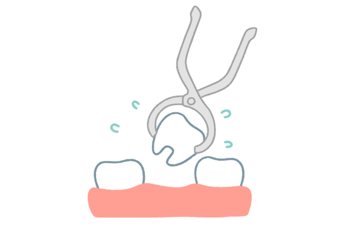 抜歯のリスクを減らせる